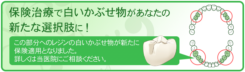 保険治療で白いかぶせ物があなたの新たな選択肢に！